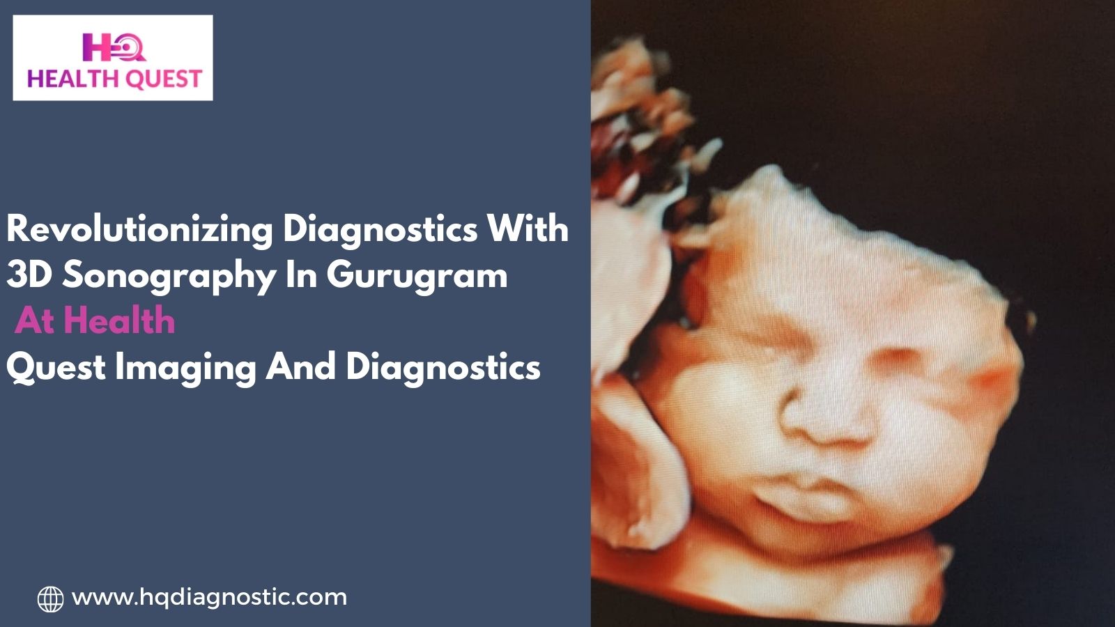 Revolutionizing Diagnostics With 3D Sonography In Gurugram At Health Quest Imaging And Diagnostics