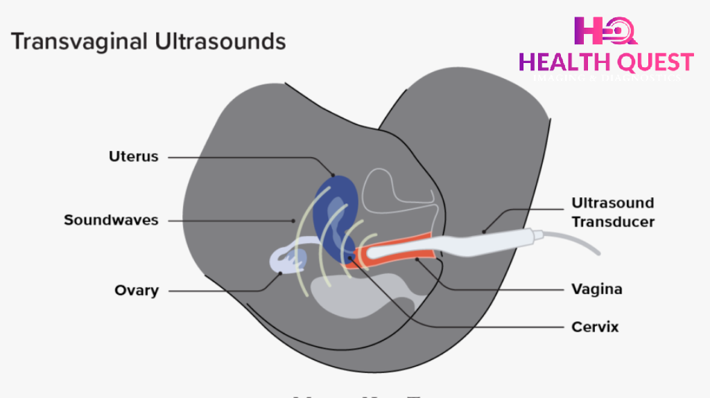 Transvaginal Ultrasound In MG Road