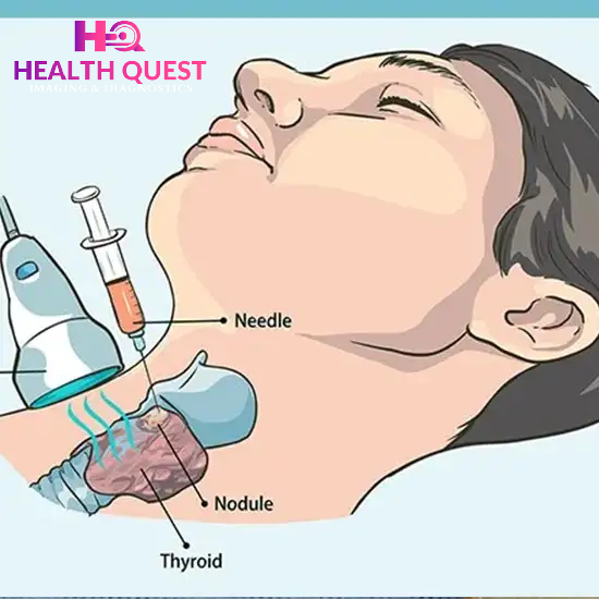 USG Guided FNAC In Gurugram Sector 14