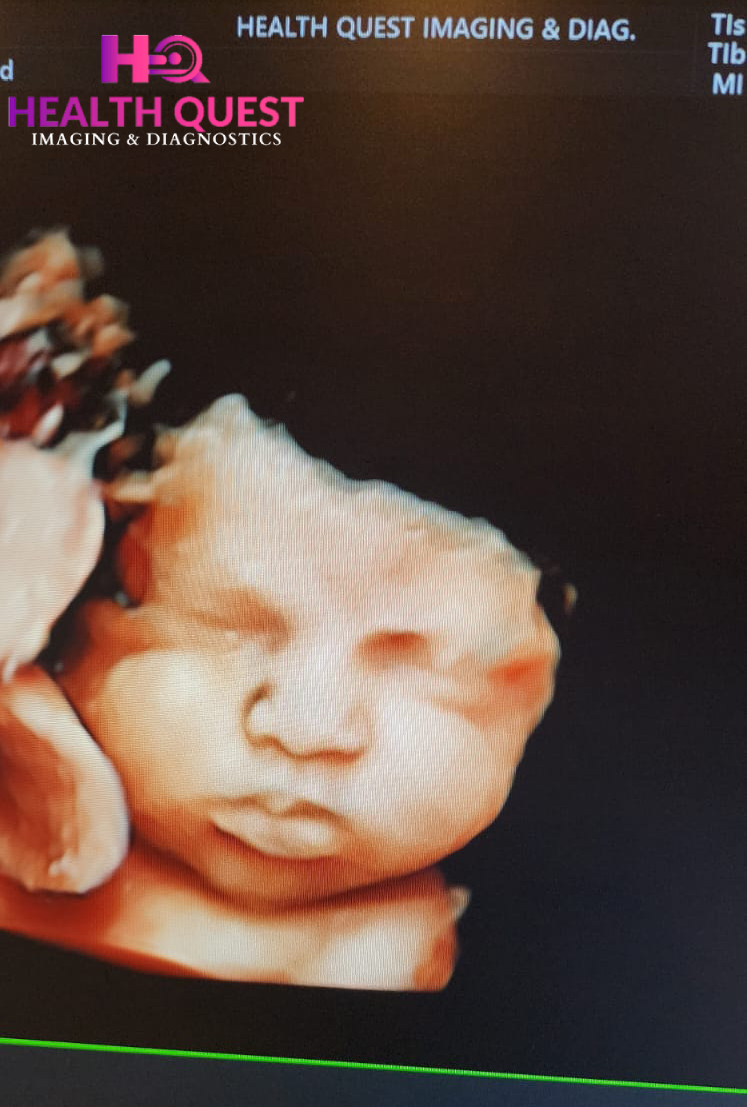 3D Sonography In Greenwood City