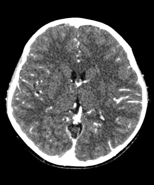 CT Head In DLF Phase 2