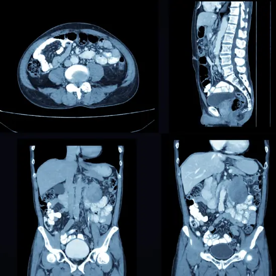 CECT Whole Abdomen In Gurugram Sector 38