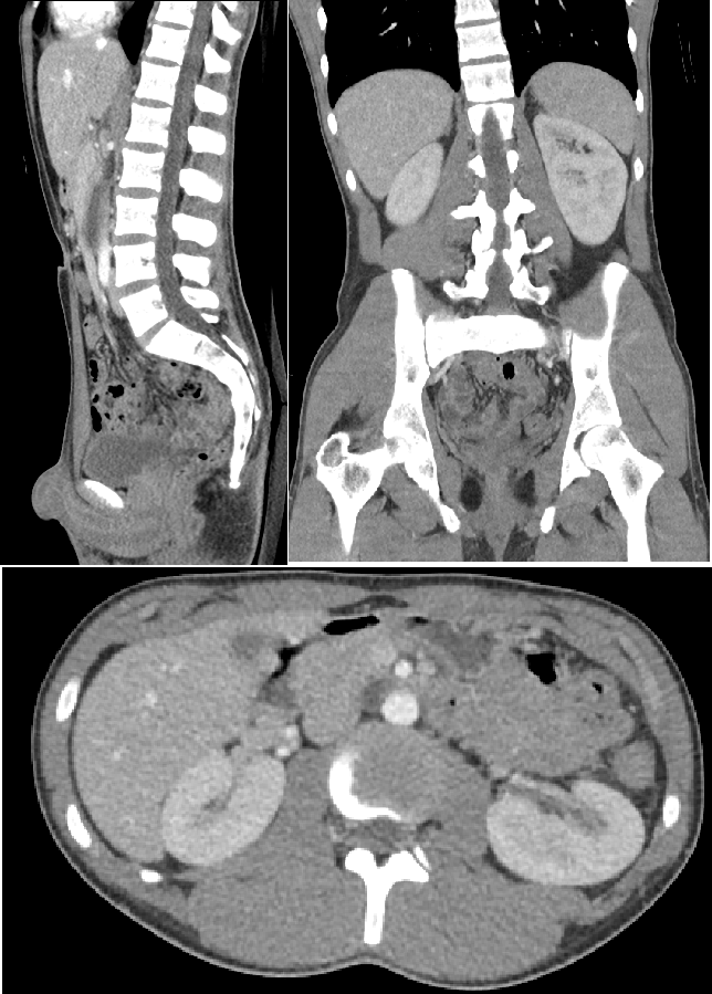 CT Abdomen And Pelvis In Gurugram Sector 38