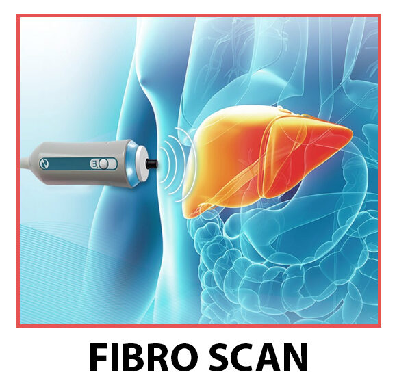 Fibro Scan In DLF Phase 2