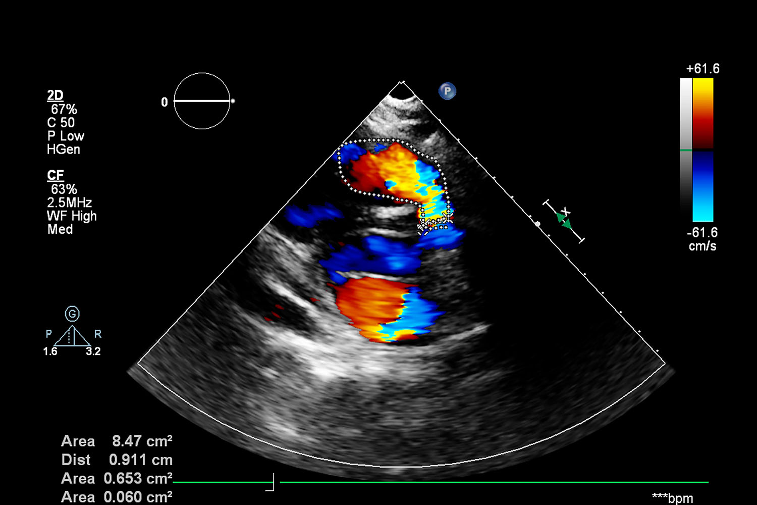 Echo In DLF Phase 2