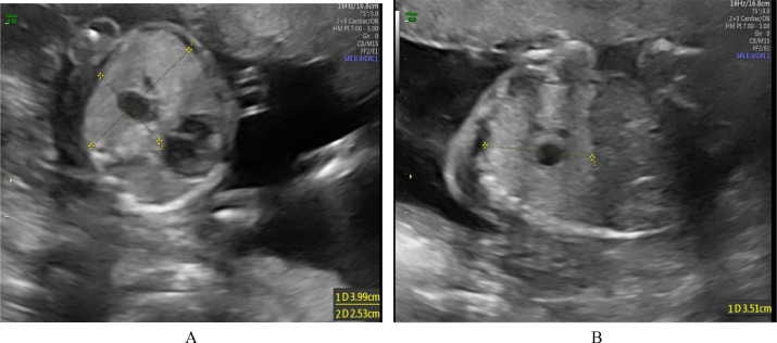 Ultrasound Doopler With Bps In Gurugram Sector 38