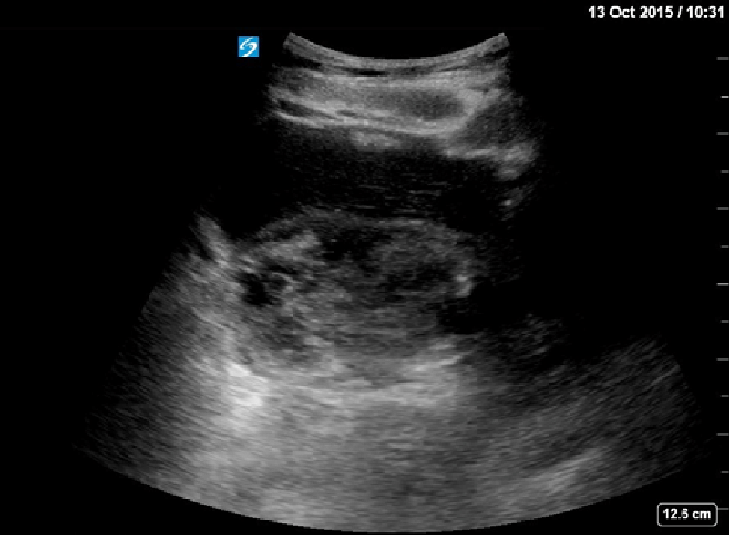 Ultrasound Lower Abdomen In Gurugram Sector 38