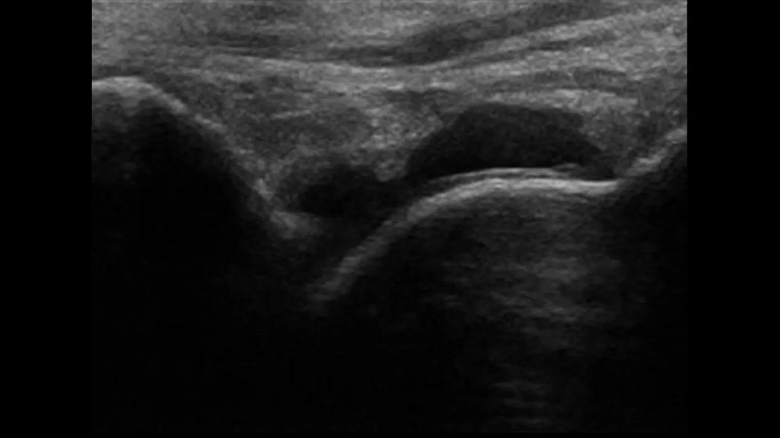 Ultrasound Ankle Joint In Gurugram Sector 38