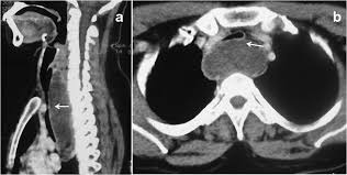 CECT Neck & Chest In DLF Phase 2