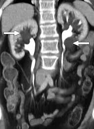 CECT Wrist Joint In DLF Phase 3