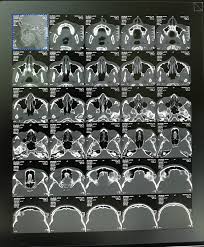 Ct 3 Film In DLF Phase 2