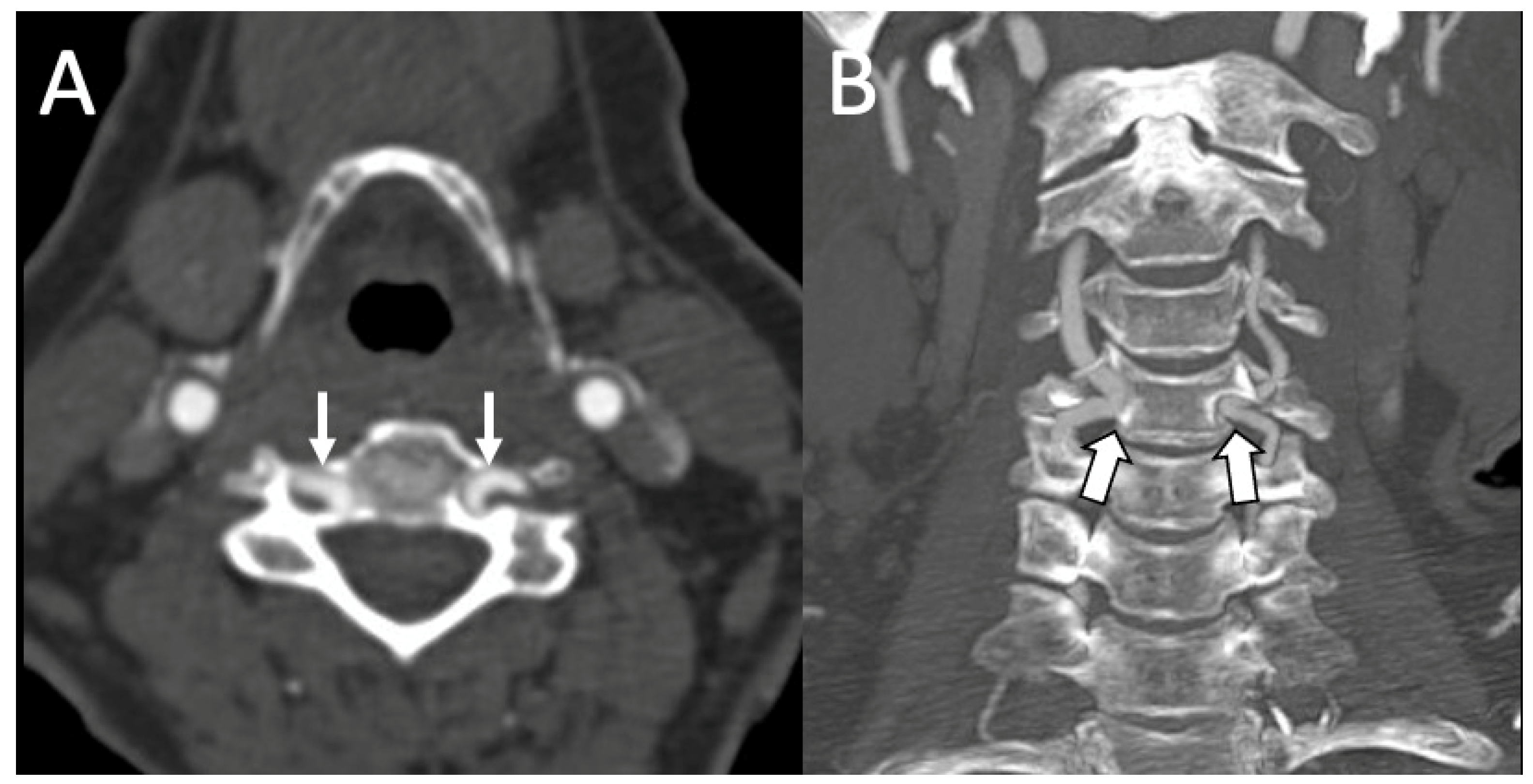 Ct Angio- Renal Arteries In Gurugram Sector 38