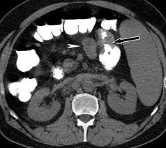 Ct Enturoclysis In Gurugram Sector 38