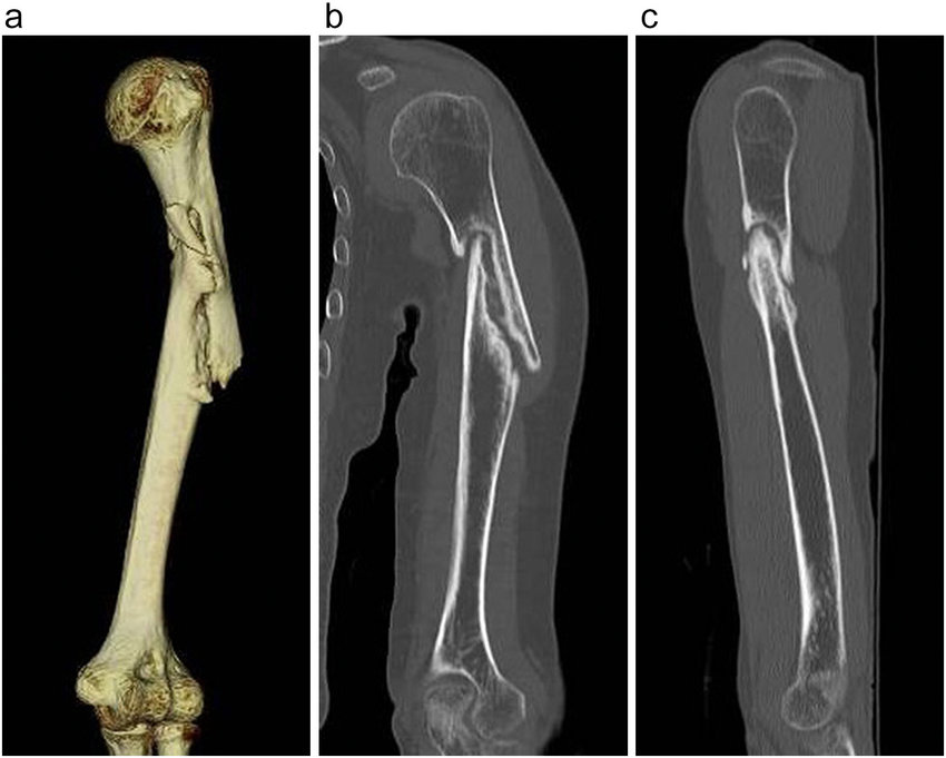 Ct Scan Hip Joint 3d In Gurugram Sector 38