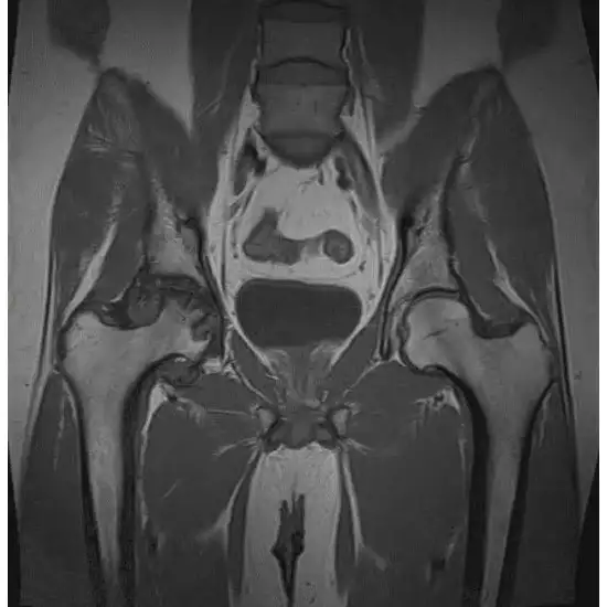 Ct Sinogram In Gurugram Sector 38