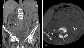 Ncct Si Joint In DLF Phase 3