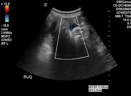 USGAFI +Doppler In DLF Phase 2