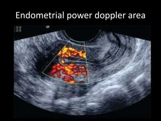 USG Doppler-TVS In DLF Phase 2