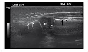 USG Elbow Joint Right In Gurugram Sector 38