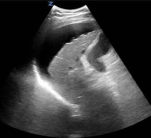 USG Fast scan In DLF Phase 3