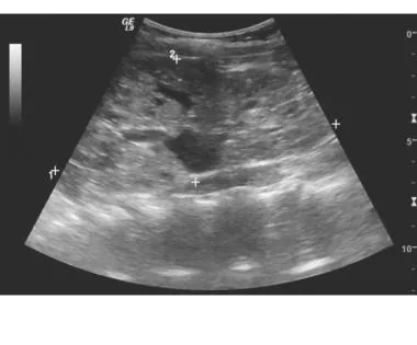 USGKub Male In DLF Phase 3