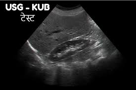 USGKub-Female In Gurugram Sector 38