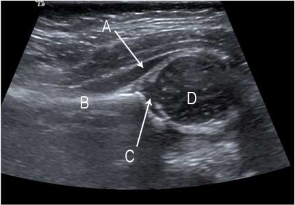 USGMSK Both Side In DLF Phase 2