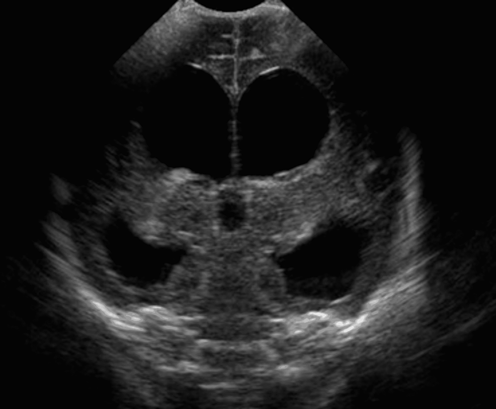 USGNeurosonogram In Gurugram Sector 38