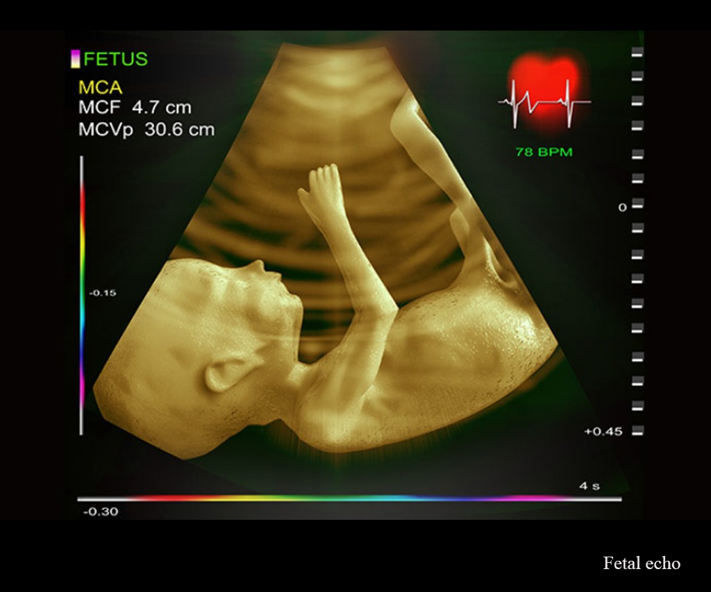 USGOBS-Fetal Echo In Gurugram Sector 38