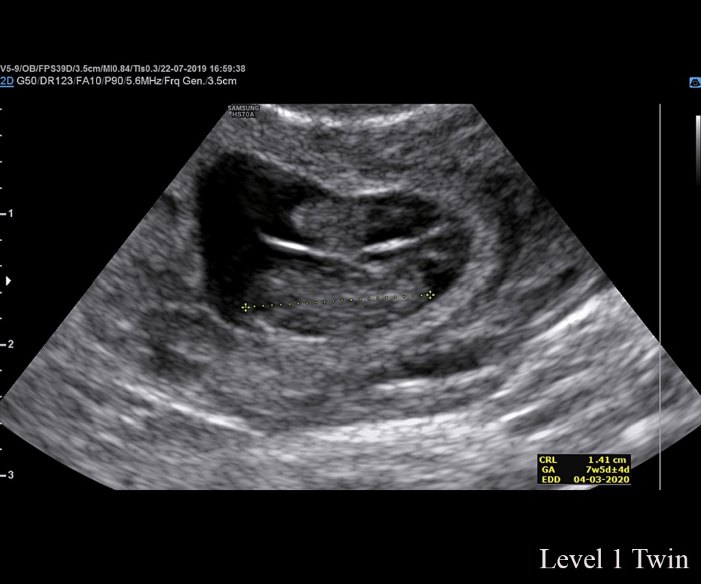 USGOBS-Level I In DLF Phase 3