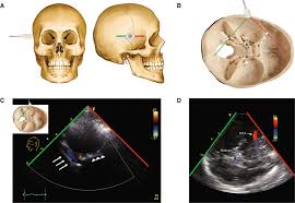 USG Temporal Bone Arterial Doppler In Gurugram Sector 38