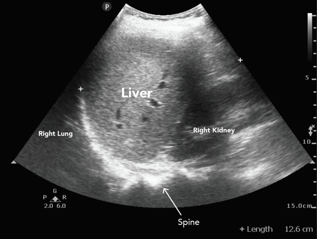 USG Whole Abdomen Female In DLF Phase 3