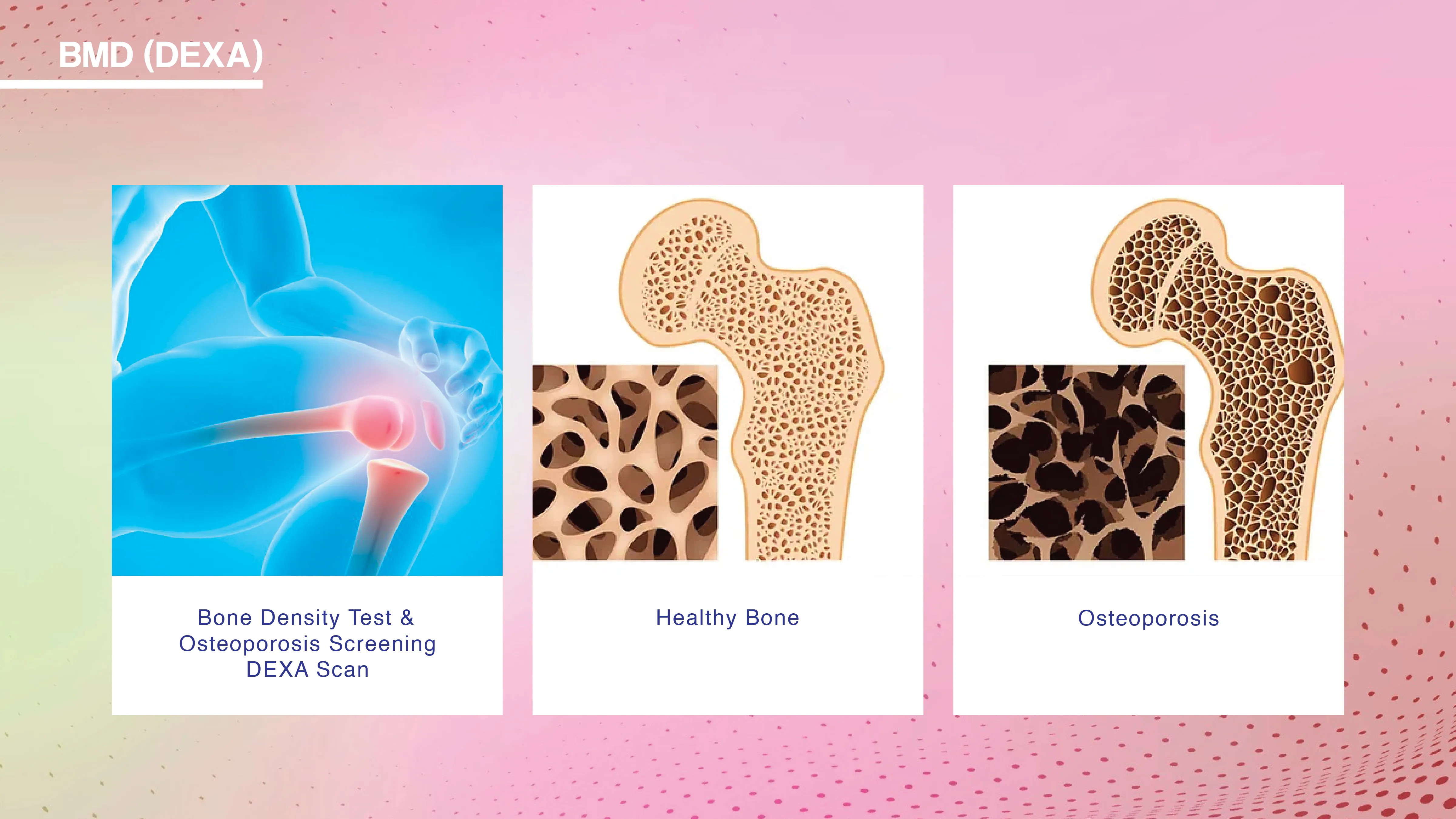 Diabetic Profile Test Package